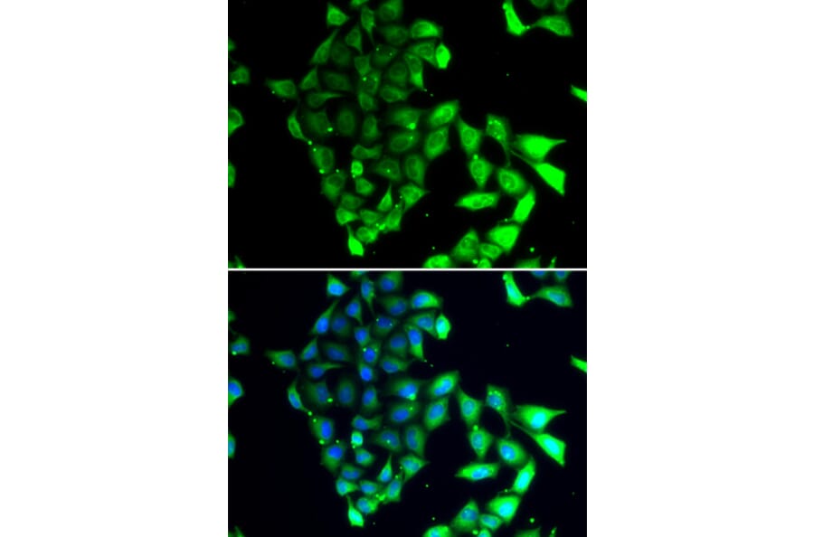 Immunofluorescence - Anti-MID1 Antibody (A15627) - Antibodies.com