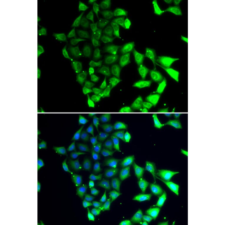 Immunofluorescence - Anti-MID1 Antibody (A15627) - Antibodies.com