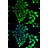 Immunofluorescence - Anti-MID1 Antibody (A15627) - Antibodies.com