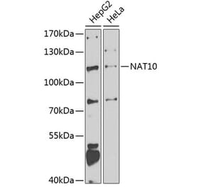 Western Blot - Anti-NAT10 Antibody (A15628) - Antibodies.com