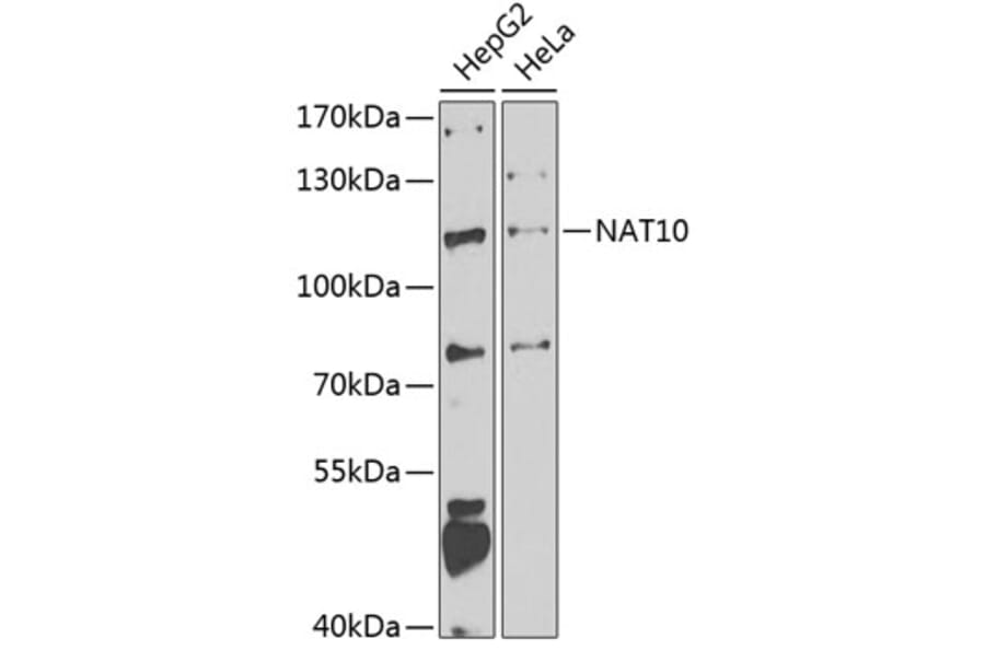 Western Blot - Anti-NAT10 Antibody (A15628) - Antibodies.com