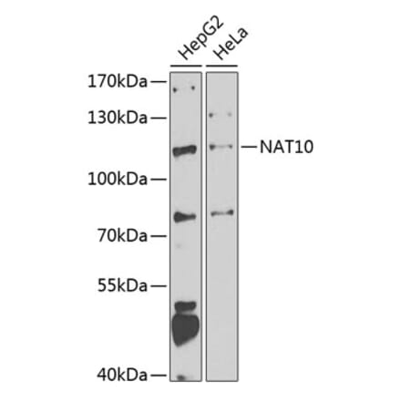 Western Blot - Anti-NAT10 Antibody (A15628) - Antibodies.com