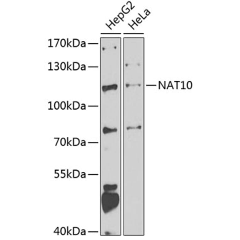 Western Blot - Anti-NAT10 Antibody (A15628) - Antibodies.com