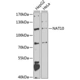 Western Blot - Anti-NAT10 Antibody (A15628) - Antibodies.com