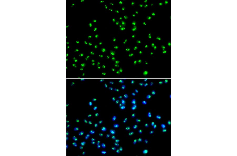Immunofluorescence - Anti-NAT10 Antibody (A15628) - Antibodies.com