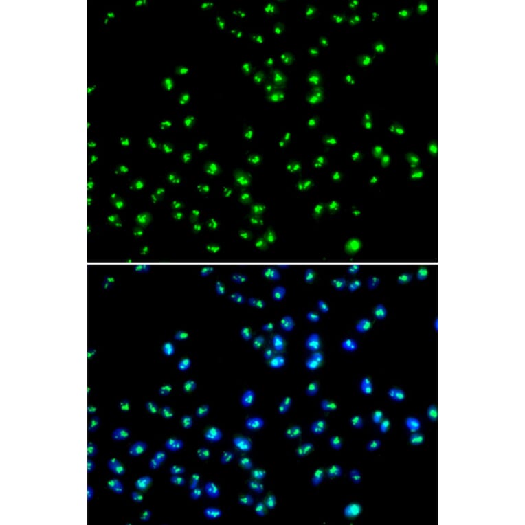Immunofluorescence - Anti-NAT10 Antibody (A15628) - Antibodies.com