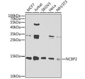 Western Blot - Anti-NCBP2 Antibody (A15629) - Antibodies.com