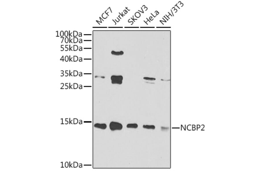 Western Blot - Anti-NCBP2 Antibody (A15629) - Antibodies.com