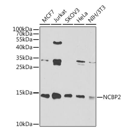 Western Blot - Anti-NCBP2 Antibody (A15629) - Antibodies.com