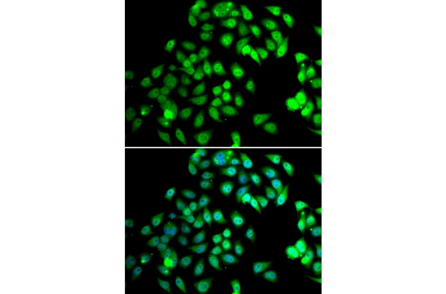 Immunofluorescence - Anti-NCBP2 Antibody (A15629) - Antibodies.com