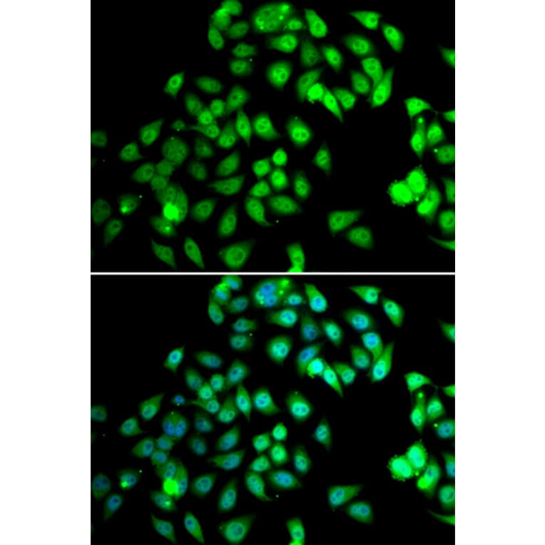 Immunofluorescence - Anti-NCBP2 Antibody (A15629) - Antibodies.com