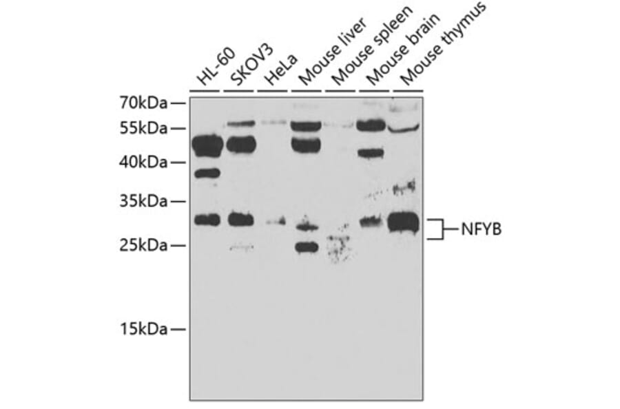 Western Blot - Anti-NFYB/CBF-B Antibody (A15630) - Antibodies.com