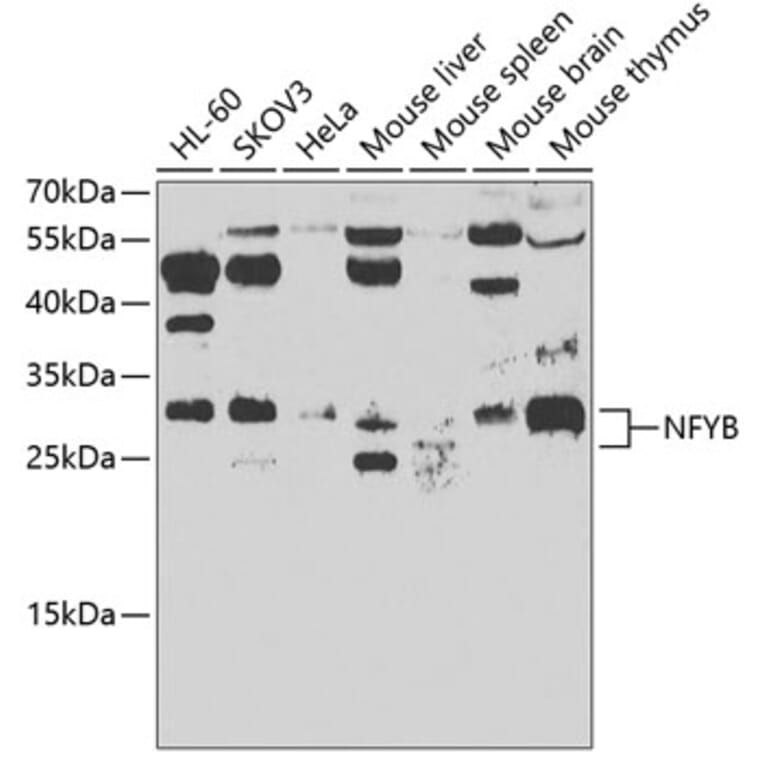 Western Blot - Anti-NFYB/CBF-B Antibody (A15630) - Antibodies.com