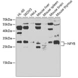 Western Blot - Anti-NFYB/CBF-B Antibody (A15630) - Antibodies.com