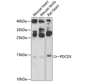 Western Blot - Anti-PDCD5 Antibody (A15631) - Antibodies.com