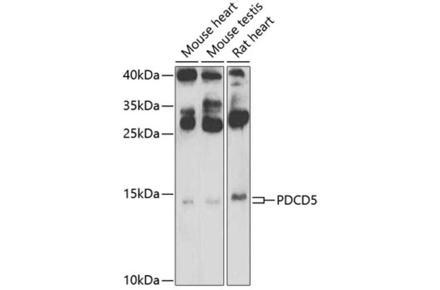 Western Blot - Anti-PDCD5 Antibody (A15631) - Antibodies.com