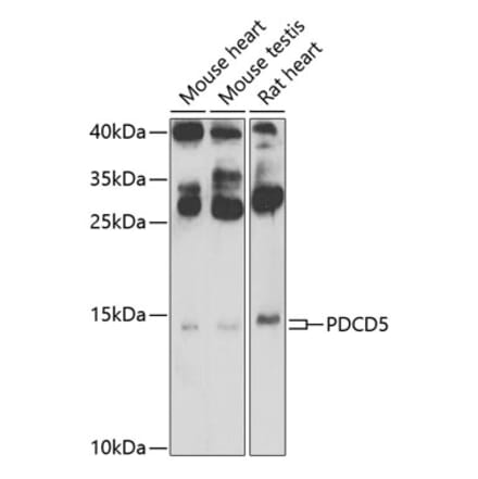 Western Blot - Anti-PDCD5 Antibody (A15631) - Antibodies.com