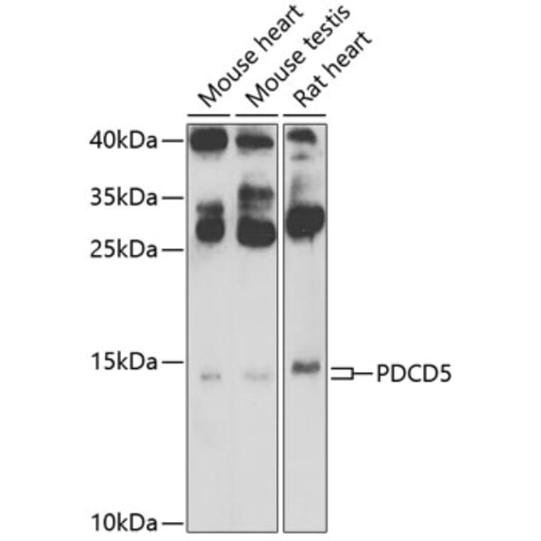 Western Blot - Anti-PDCD5 Antibody (A15631) - Antibodies.com