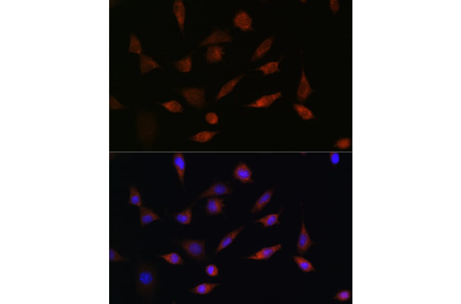 Immunofluorescence - Anti-PDCD5 Antibody (A15631) - Antibodies.com