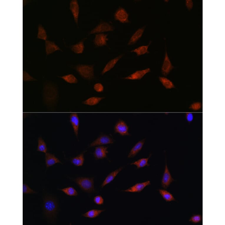 Immunofluorescence - Anti-PDCD5 Antibody (A15631) - Antibodies.com