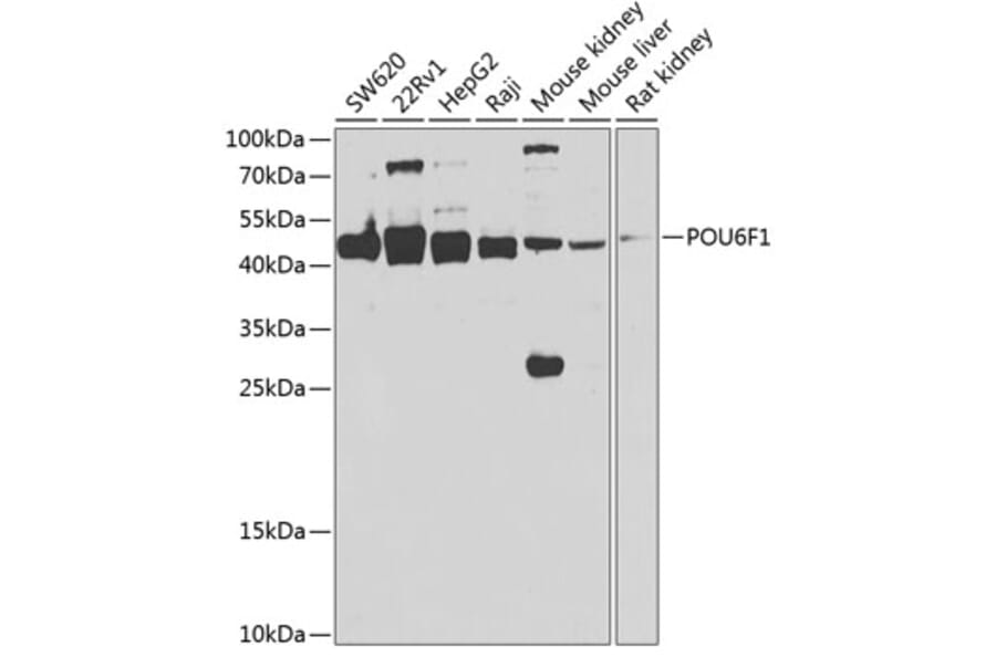 Western Blot - Anti-POU6F1/Emb Antibody (A15632) - Antibodies.com