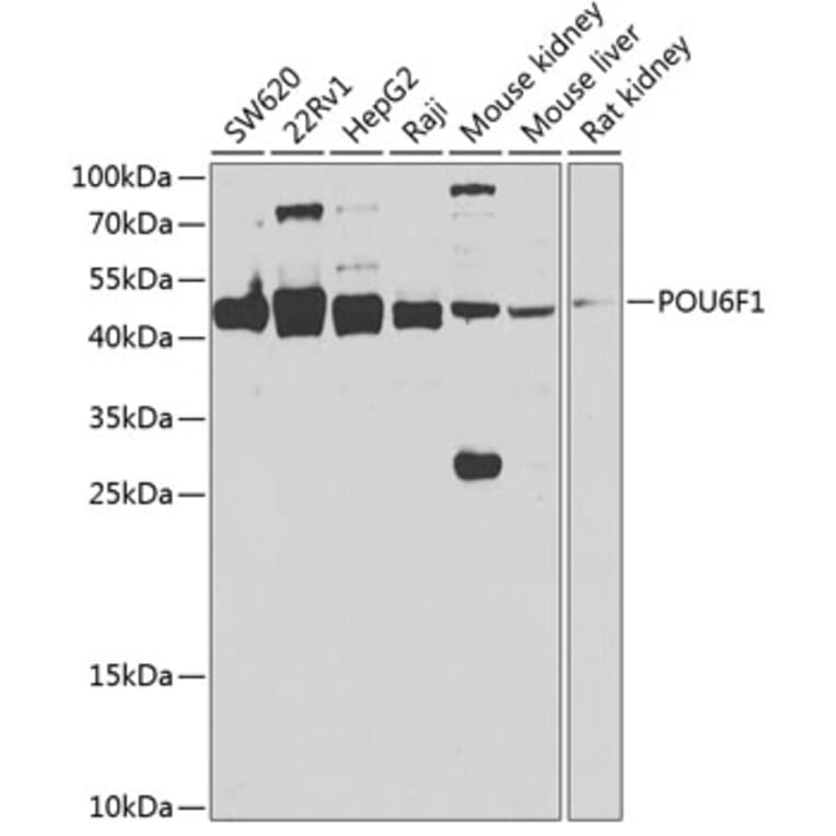 Western Blot - Anti-POU6F1/Emb Antibody (A15632) - Antibodies.com