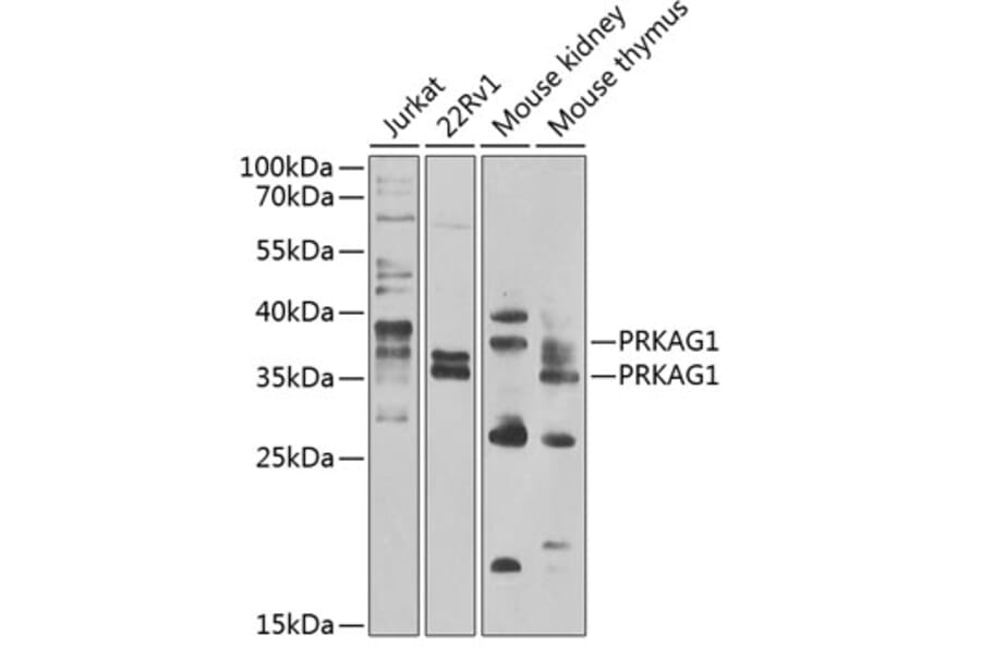 Western Blot - Anti-AMPK gamma 1 Antibody (A15633) - Antibodies.com