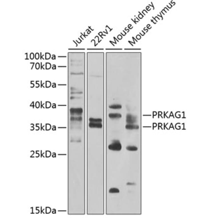 Western Blot - Anti-AMPK gamma 1 Antibody (A15633) - Antibodies.com