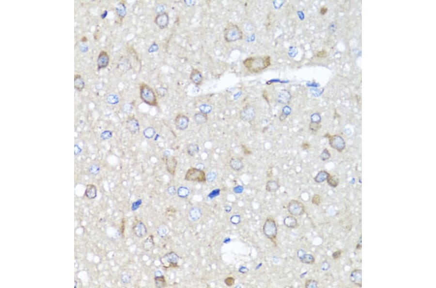 Immunohistochemistry - Anti-AMPK gamma 1 Antibody (A15633) - Antibodies.com