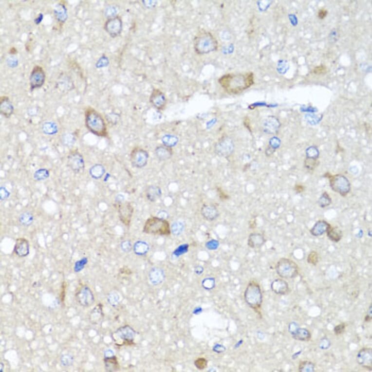 Immunohistochemistry - Anti-AMPK gamma 1 Antibody (A15633) - Antibodies.com