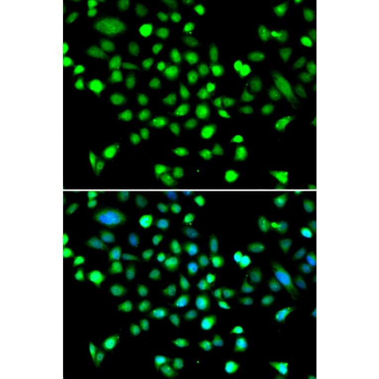 Immunofluorescence - Anti-AMPK gamma 1 Antibody (A15633) - Antibodies.com