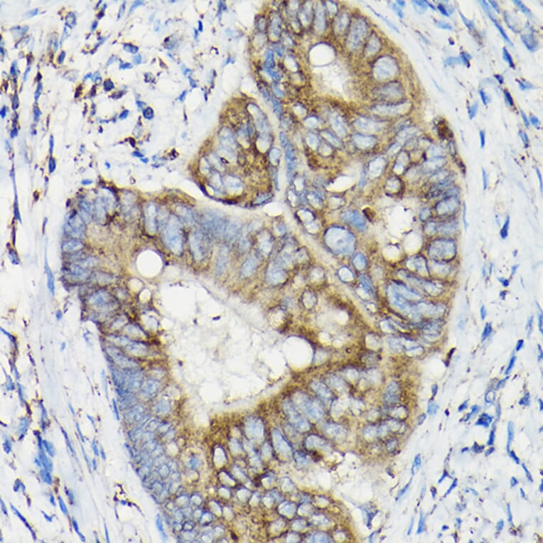 Immunohistochemistry - Anti-SIRT3 Antibody (A15635) - Antibodies.com
