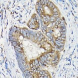Immunohistochemistry - Anti-SIRT3 Antibody (A15635) - Antibodies.com