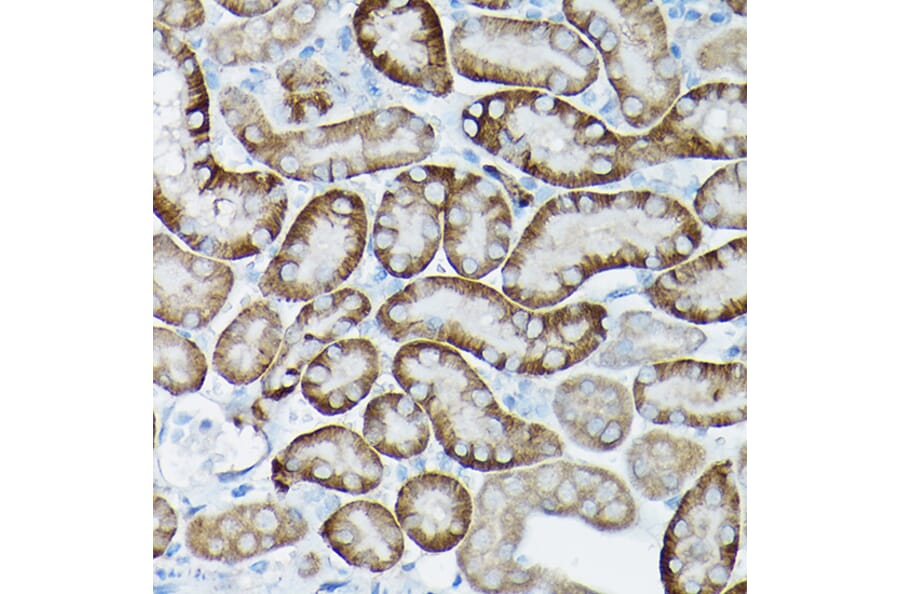 Immunohistochemistry - Anti-SIRT3 Antibody (A15635) - Antibodies.com