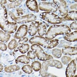 Immunohistochemistry - Anti-SIRT3 Antibody (A15635) - Antibodies.com