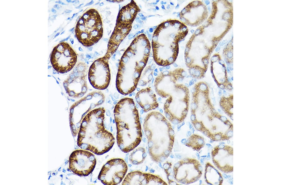Immunohistochemistry - Anti-SIRT3 Antibody (A15635) - Antibodies.com