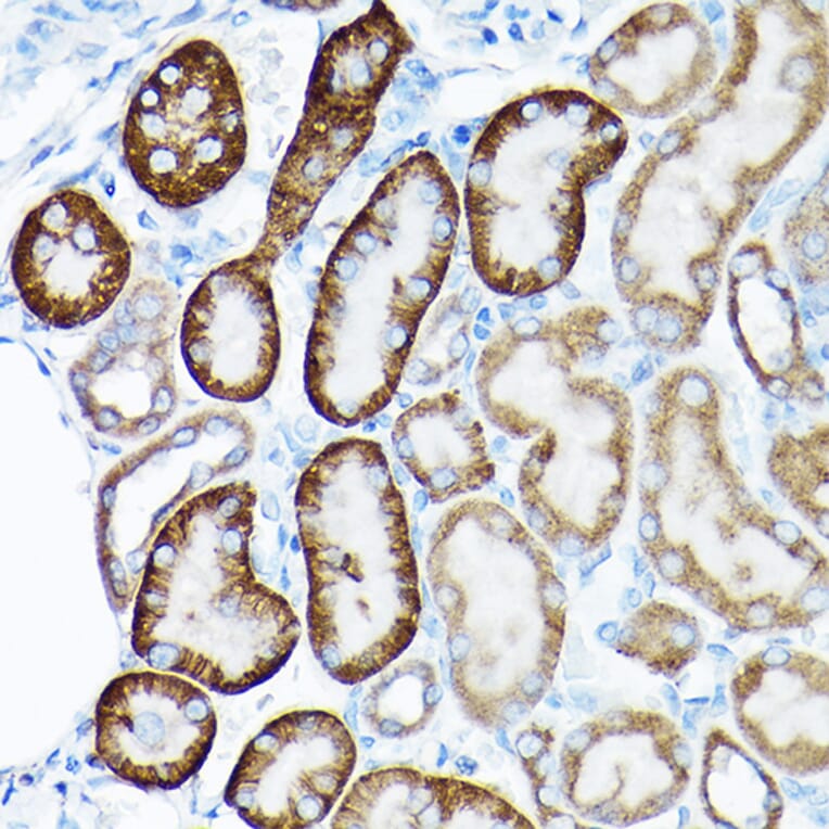 Immunohistochemistry - Anti-SIRT3 Antibody (A15635) - Antibodies.com