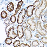 Immunohistochemistry - Anti-SIRT3 Antibody (A15635) - Antibodies.com