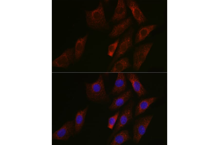 Immunofluorescence - Anti-SIRT3 Antibody (A15635) - Antibodies.com