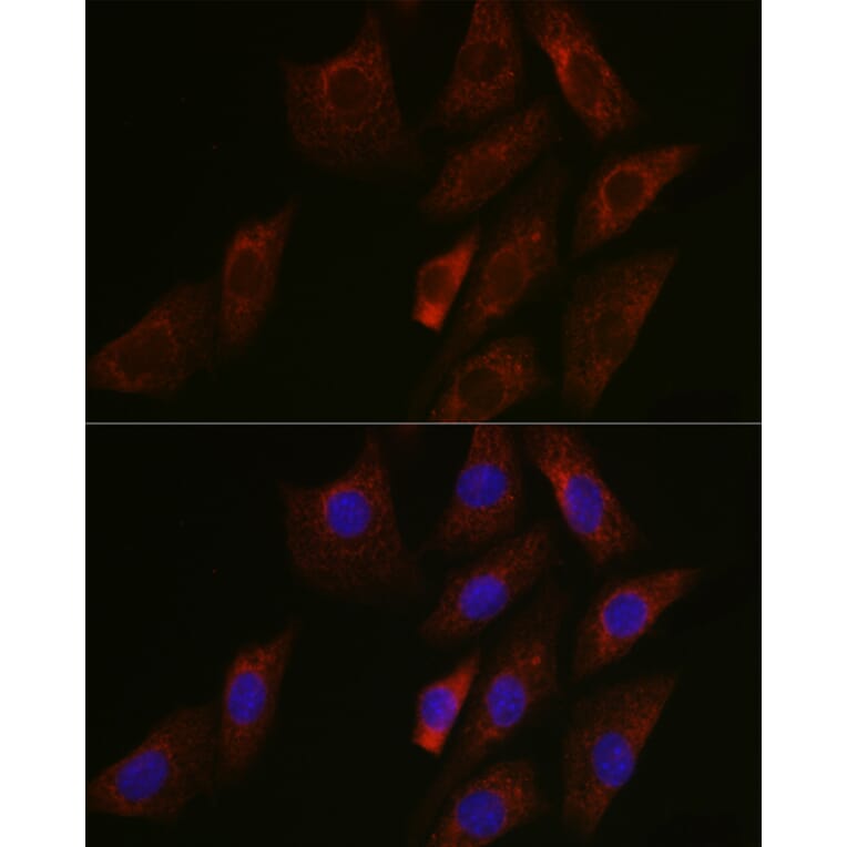 Immunofluorescence - Anti-SIRT3 Antibody (A15635) - Antibodies.com