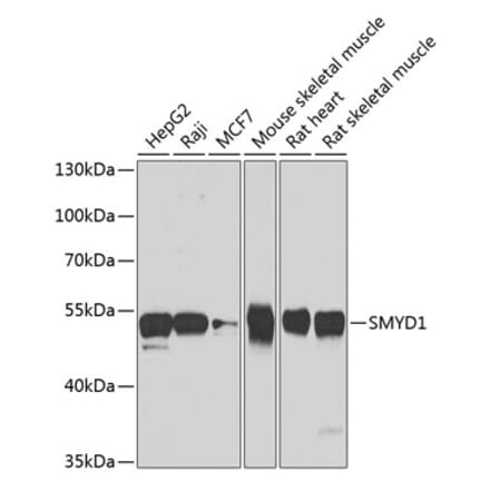 Western Blot - Anti-SMYD1 Antibody (A15636) - Antibodies.com