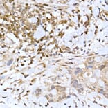 Immunohistochemistry - Anti-TFEB Antibody (A15637) - Antibodies.com