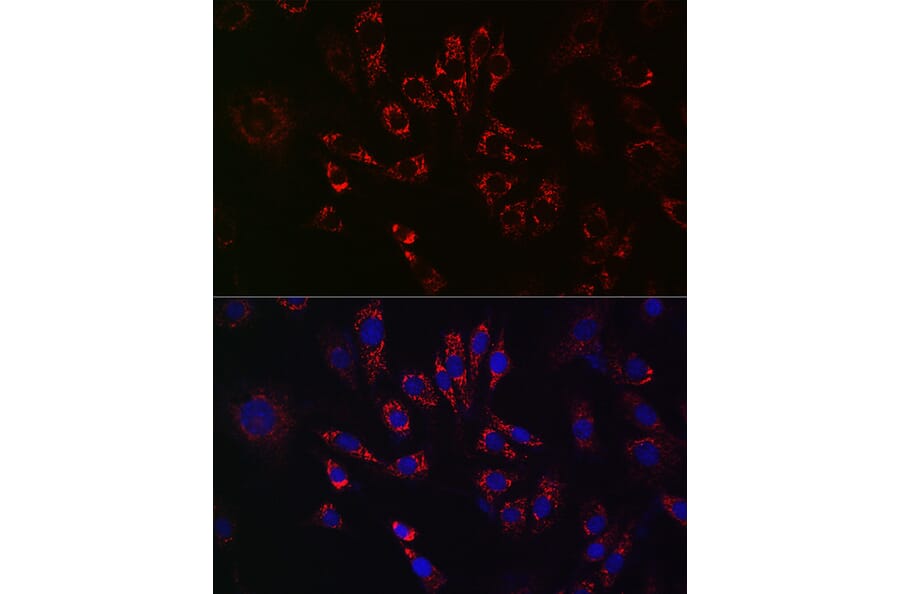 Immunofluorescence - Anti-TFEB Antibody (A15637) - Antibodies.com