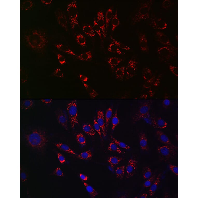 Immunofluorescence - Anti-TFEB Antibody (A15637) - Antibodies.com