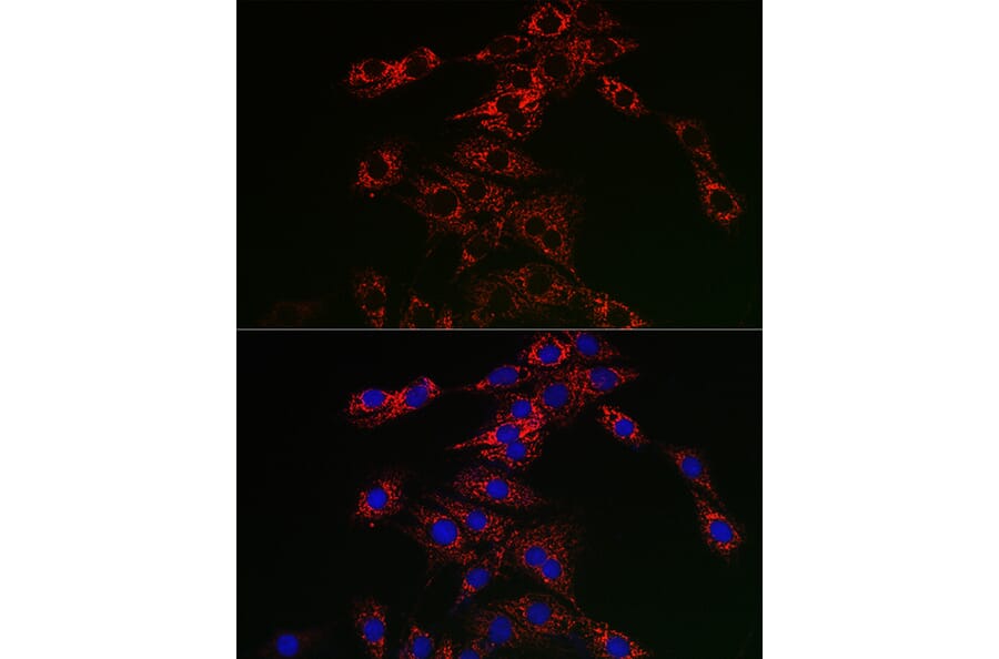 Immunofluorescence - Anti-TFEB Antibody (A15637) - Antibodies.com