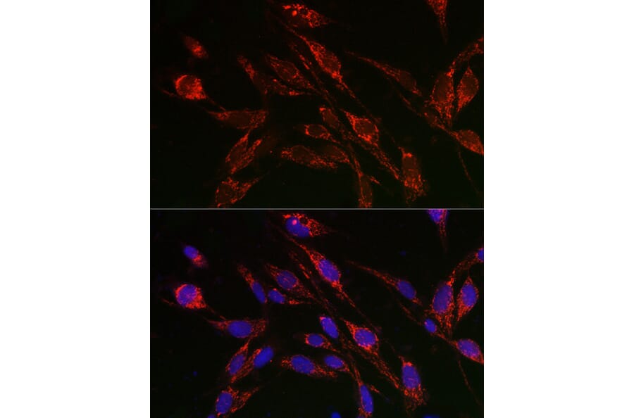 Immunofluorescence - Anti-TFEB Antibody (A15637) - Antibodies.com