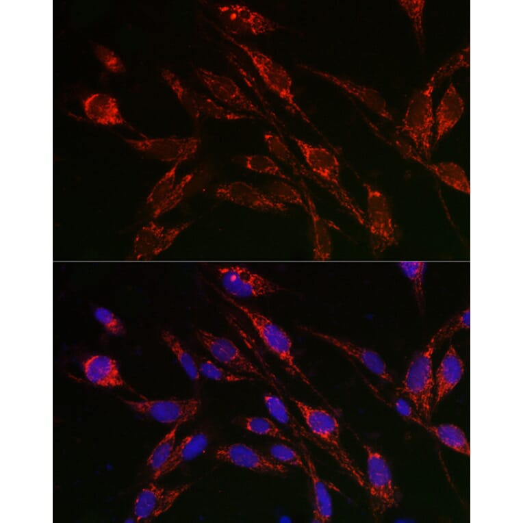 Immunofluorescence - Anti-TFEB Antibody (A15637) - Antibodies.com