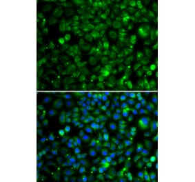 Immunofluorescence - Anti-TMLHE Antibody (A15638) - Antibodies.com