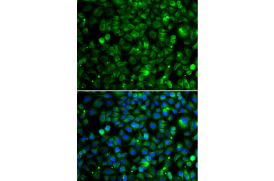 Immunofluorescence - Anti-TMLHE Antibody (A7312) - Antibodies.com