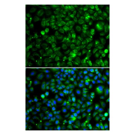 Immunofluorescence - Anti-TMLHE Antibody (A15638) - Antibodies.com